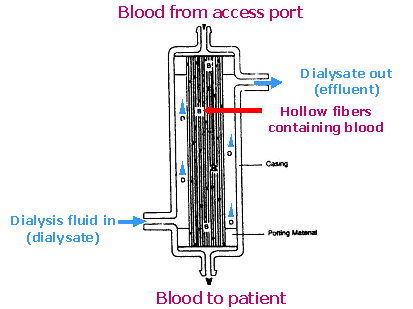 CRRT diagram